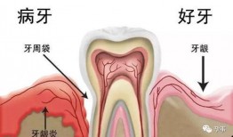 爆料小孩长智齿视频播放,网友直呼可爱到爆